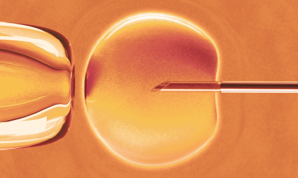 Umělé oplodnění in vitro